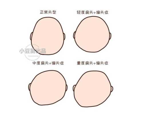 胎儿头大聪明(胎儿头大聪明还是头小聪明) 第3张 胎儿头大聪明(胎儿头大聪明还是头小聪明) 第3张