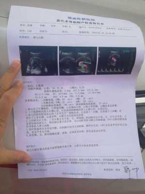 胎儿心脏亮点(怀孕33周,还能做胎儿心脏彩超吗) 第2张 胎儿心脏亮点(怀孕33周,还能做胎儿心脏彩超吗) 第2张