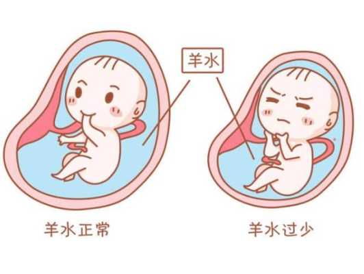 胎儿吞羊水(羊水多吃什么排水) 第2张 胎儿吞羊水(羊水多吃什么排水) 第2张