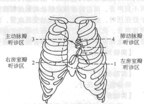 听胎儿心音(听胎儿心音的位置) 第1张 听胎儿心音(听胎儿心音的位置) 第1张