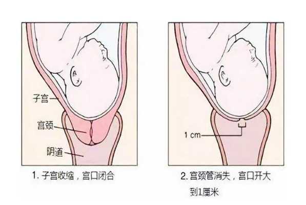预产期到了,宫颈不软化应该怎么办呢,孕期宫颈软是什么意思 第1张 预产期到了,宫颈不软化应该怎么办呢,孕期宫颈软是什么意思 第1张