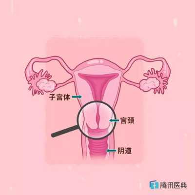 预产期到了,宫颈不软化应该怎么办呢,孕期宫颈软是什么意思 第2张 预产期到了,宫颈不软化应该怎么办呢,孕期宫颈软是什么意思 第2张