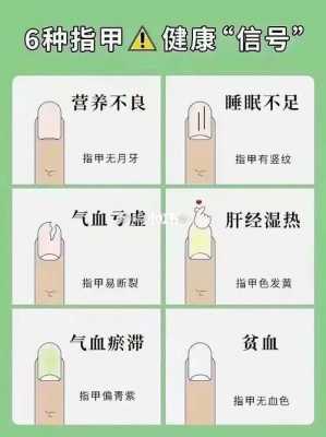 孕期包指甲(用指甲花包指甲的好处) 第1张 孕期包指甲(用指甲花包指甲的好处) 第1张