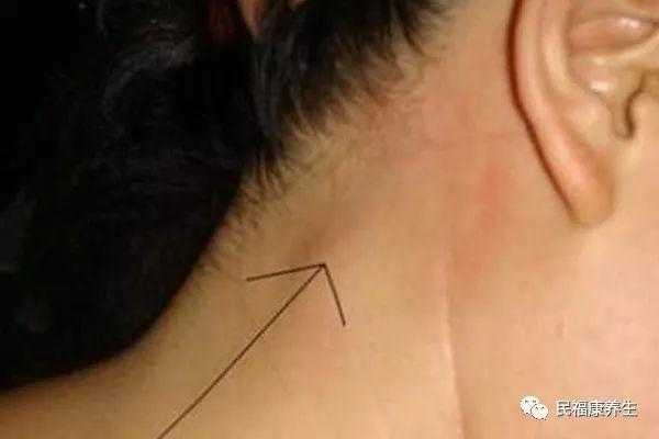 孕期淋巴发炎(孕期淋巴发炎对胎儿有影响吗) 第2张 孕期淋巴发炎(孕期淋巴发炎对胎儿有影响吗) 第2张