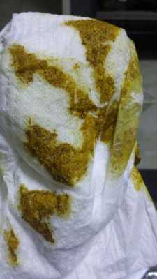 孕期屎尿多(孕妇一天大便七八遍,这是很正常吗) 第2张 孕期屎尿多(孕妇一天大便七八遍,这是很正常吗) 第2张