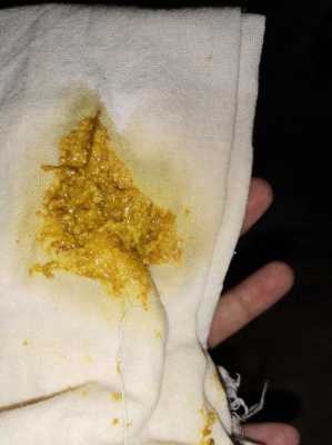 孕期屎尿多(孕妇一天大便七八遍,这是很正常吗) 第3张 孕期屎尿多(孕妇一天大便七八遍,这是很正常吗) 第3张