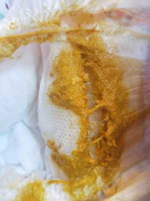 孕期屎尿多(孕妇一天大便七八遍,这是很正常吗) 第1张 孕期屎尿多(孕妇一天大便七八遍,这是很正常吗) 第1张
