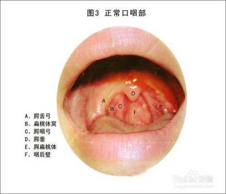 孕期喉咙烧灼（孕期喉咙烧灼感是什么原因引起的）  第1张