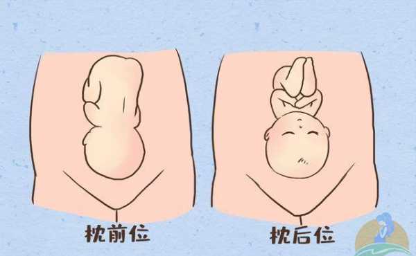 怎么自我判断胎儿是不是横位,b超胎儿横位什么意思 第2张 怎么自我判断胎儿是不是横位,b超胎儿横位什么意思 第2张