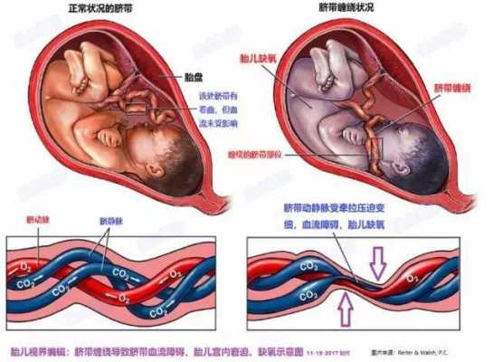 脐带连接胎儿什么器官(脐带连接胎儿什么器官最好) 第3张 脐带连接胎儿什么器官(脐带连接胎儿什么器官最好) 第3张