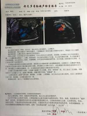 怀孕24周胎儿彩超图(怀孕24周四维彩超左心室有两个强回声点怎么办) 第2张 怀孕24周胎儿彩超图(怀孕24周四维彩超左心室有两个强回声点怎么办) 第2张