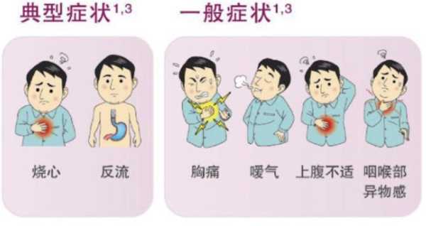孕期胃灼热(【胃部烧灼感是什么原因】) 第1张 孕期胃灼热(【胃部烧灼感是什么原因】) 第1张