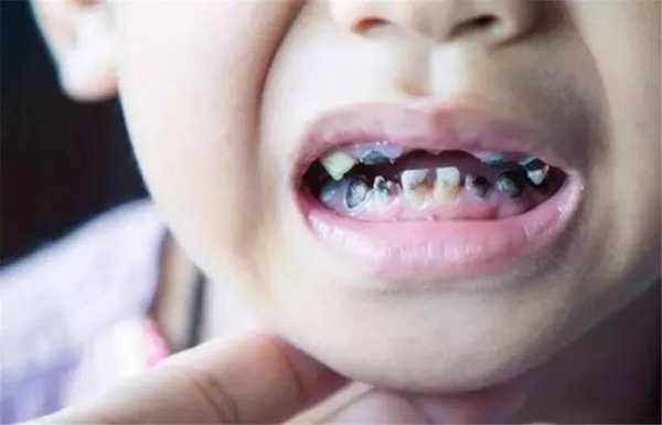 孕妇吃糖对胎儿的影响(孕妇吃糖对胎儿的影响) 第3张 孕妇吃糖对胎儿的影响(孕妇吃糖对胎儿的影响) 第3张