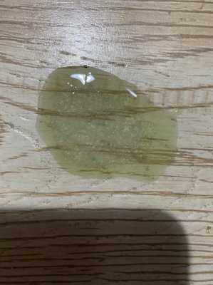 孕期吐绿水(孕期吐绿水很苦是什么原因) 第3张 孕期吐绿水(孕期吐绿水很苦是什么原因) 第3张
