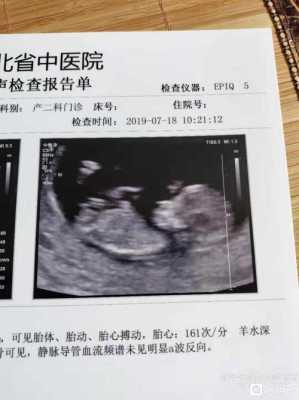 鼻梁骨的正常宽度,胎儿鼻骨各孕期参照 第2张 鼻梁骨的正常宽度,胎儿鼻骨各孕期参照 第2张