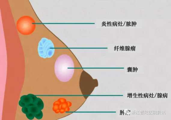 孕期乳晕周围(怀孕4个月,为什么乳房周围变黑) 第2张 孕期乳晕周围(怀孕4个月,为什么乳房周围变黑) 第2张