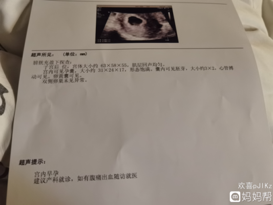 四十天小孩会不会认妈,怀孕40天胎儿有心跳吗正常吗 第3张 四十天小孩会不会认妈,怀孕40天胎儿有心跳吗正常吗 第3张