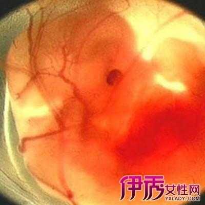 怀孕两个半月胎儿图(怀孕两个半月胎儿图片) 第2张 怀孕两个半月胎儿图(怀孕两个半月胎儿图片) 第2张