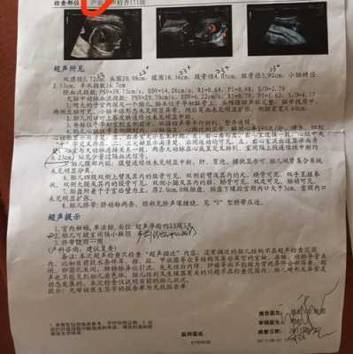 胎儿心脏畸形会误查吗(胎儿心脏畸形会误查吗怎么办) 第2张 胎儿心脏畸形会误查吗(胎儿心脏畸形会误查吗怎么办) 第2张