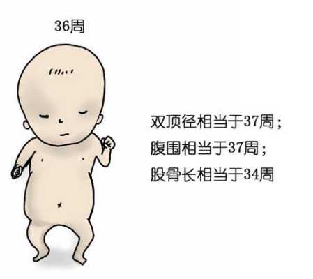 胎儿头大腿短是畸形吗(胎儿头大腿短是畸形吗图片) 第2张 胎儿头大腿短是畸形吗(胎儿头大腿短是畸形吗图片) 第2张