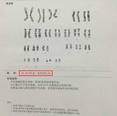 男性染色体怎么检查,胎儿查染色体怎么查的 第2张 男性染色体怎么检查,胎儿查染色体怎么查的 第2张