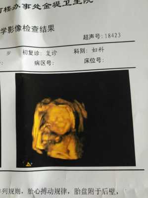 五个月胎儿的彩超图(五个月胎儿的彩超图片) 第2张 五个月胎儿的彩超图(五个月胎儿的彩超图片) 第2张