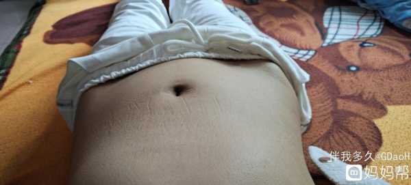 如果宝宝没有胎心,肚子还会大嘛,孕期肚子超大怎么回事? 第2张 如果宝宝没有胎心,肚子还会大嘛,孕期肚子超大怎么回事? 第2张