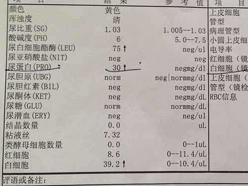 孕妇尿检酸碱度7.5正常吗,怀孕验尿数值 第2张 孕妇尿检酸碱度7.5正常吗,怀孕验尿数值 第2张