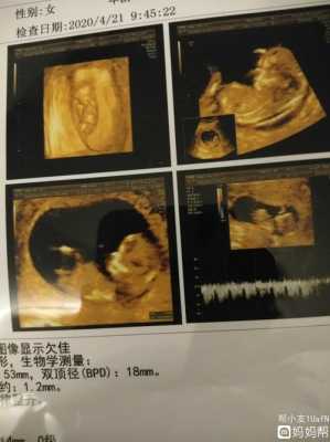 胎儿五官什么时候形成(婴儿脸型什么时候定型) 第2张 胎儿五官什么时候形成(婴儿脸型什么时候定型) 第2张
