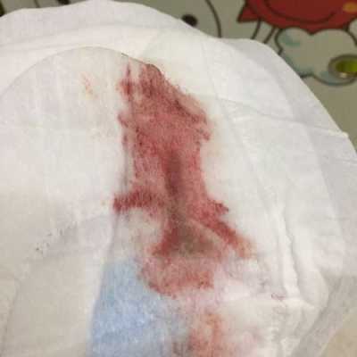 着床出血是怎么回事,孕期着床出血会持续多久 第3张 着床出血是怎么回事,孕期着床出血会持续多久 第3张
