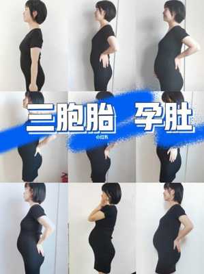 怀三胞胎 胎儿成活率(怀三胞胎胎儿成活率) 第3张 怀三胞胎 胎儿成活率(怀三胞胎胎儿成活率) 第3张