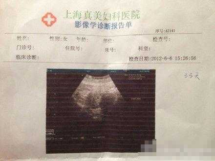b超单子比实际孕周数偏大三天左右正常吗,胎儿偏大一个月正常吗  第2张