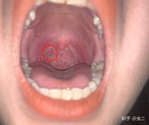 孕期乳头脏(乳头上的脏东西怎么清理) 第2张 孕期乳头脏(乳头上的脏东西怎么清理) 第2张