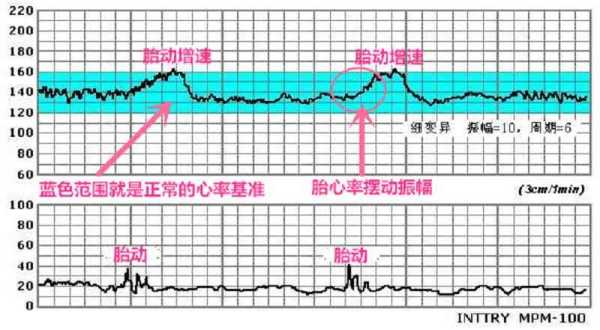 孕妇宝宝在肚子里心率多少算正常的啊,胎儿听心率能知道男女吗 第1张 孕妇宝宝在肚子里心率多少算正常的啊,胎儿听心率能知道男女吗 第1张