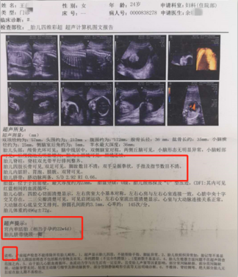 胎儿检测畸形(胎儿检测畸形怎么办) 第3张 胎儿检测畸形(胎儿检测畸形怎么办) 第3张