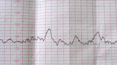 孕期反胃酸是怎么回事?怀孕几个月的时候这些孕反应才会消失呢,孕期呕吐反应大是男孩还是女孩 第1张 孕期反胃酸是怎么回事?怀孕几个月的时候这些孕反应才会消失呢,孕期呕吐反应大是男孩还是女孩 第1张