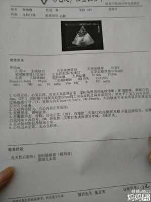 胎儿补心脏（宝宝心脏室缺怎么办）  第1张