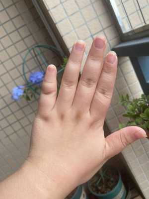 胎儿手偏短（胎儿手偏短是什么原因）  第2张