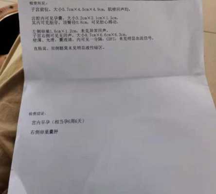 怀孕了有囊肿孩子能要吗,胎儿襄肿是怎么回事 第1张 怀孕了有囊肿孩子能要吗,胎儿襄肿是怎么回事 第1张