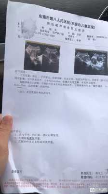 怀孕了有囊肿孩子能要吗,胎儿襄肿是怎么回事 第2张 怀孕了有囊肿孩子能要吗,胎儿襄肿是怎么回事 第2张