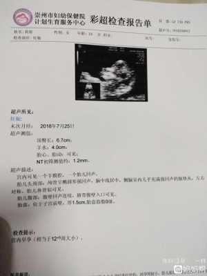 胎儿超声NT(胎儿超声nt值正常范围) 第2张 胎儿超声NT(胎儿超声nt值正常范围) 第2张