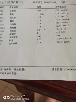 孕期尿蛋白3(尿蛋白3个加号怎么治) 第2张 孕期尿蛋白3(尿蛋白3个加号怎么治) 第2张