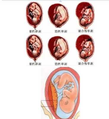 为什么胎盘里没有胎伢,胎儿没有胎盘会怎样 第3张 为什么胎盘里没有胎伢,胎儿没有胎盘会怎样 第3张