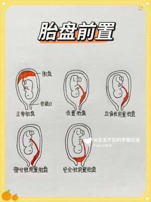 为什么胎盘里没有胎伢,胎儿没有胎盘会怎样 第1张 为什么胎盘里没有胎伢,胎儿没有胎盘会怎样 第1张