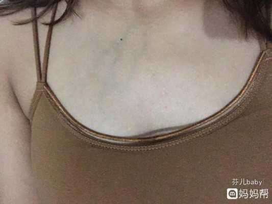 乳房青筋明显怎么回事,孕期乳房有青筋是怎么回事 第1张 乳房青筋明显怎么回事,孕期乳房有青筋是怎么回事 第1张