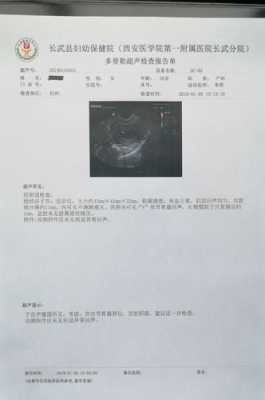 孕期宫内积液(孕期出血宫腔有激液怎么办) 第2张 孕期宫内积液(孕期出血宫腔有激液怎么办) 第2张