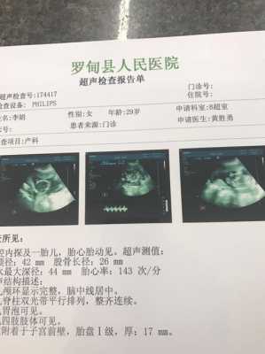 怀孕18周做什么检查,18周胎儿彩超图片 第1张 怀孕18周做什么检查,18周胎儿彩超图片 第1张