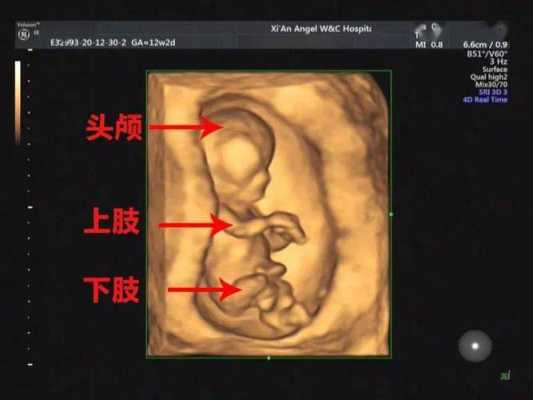 三维胎儿图(二维三维四维空间区别) 第1张 三维胎儿图(二维三维四维空间区别) 第1张
