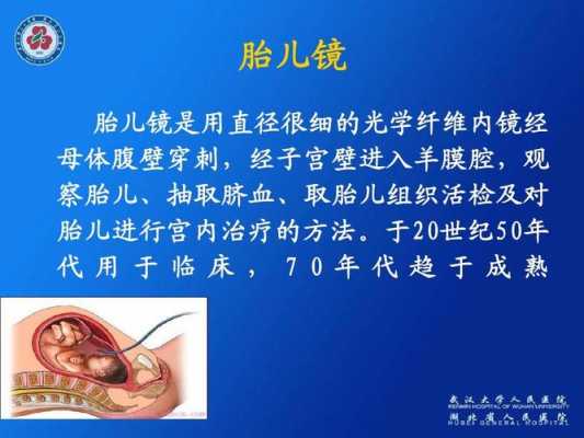 胎镜是什么,胎儿镜的费用多少钱 第2张 胎镜是什么,胎儿镜的费用多少钱 第2张
