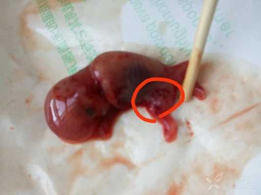 怀孕10周有什么症状?孕十周了会不会出现恶心想吐的症状呢,怀孕10周胎儿图片 第1张 怀孕10周有什么症状?孕十周了会不会出现恶心想吐的症状呢,怀孕10周胎儿图片 第1张